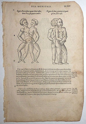 Item #008741 16th-century leaf with four illustrations of conjoined twins from Ambroise Paré’s...